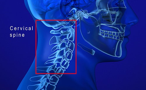 C3 C4 C5 Vertebrae Spinal Cord Injury SpinalCord